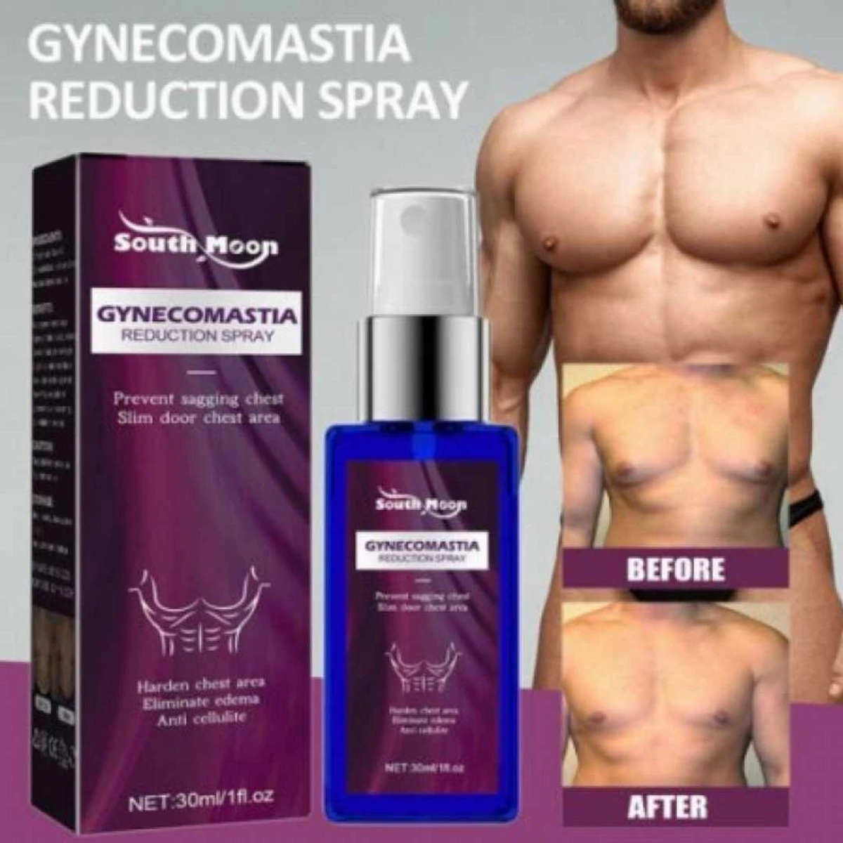 Gynecomastia Reduction Spray