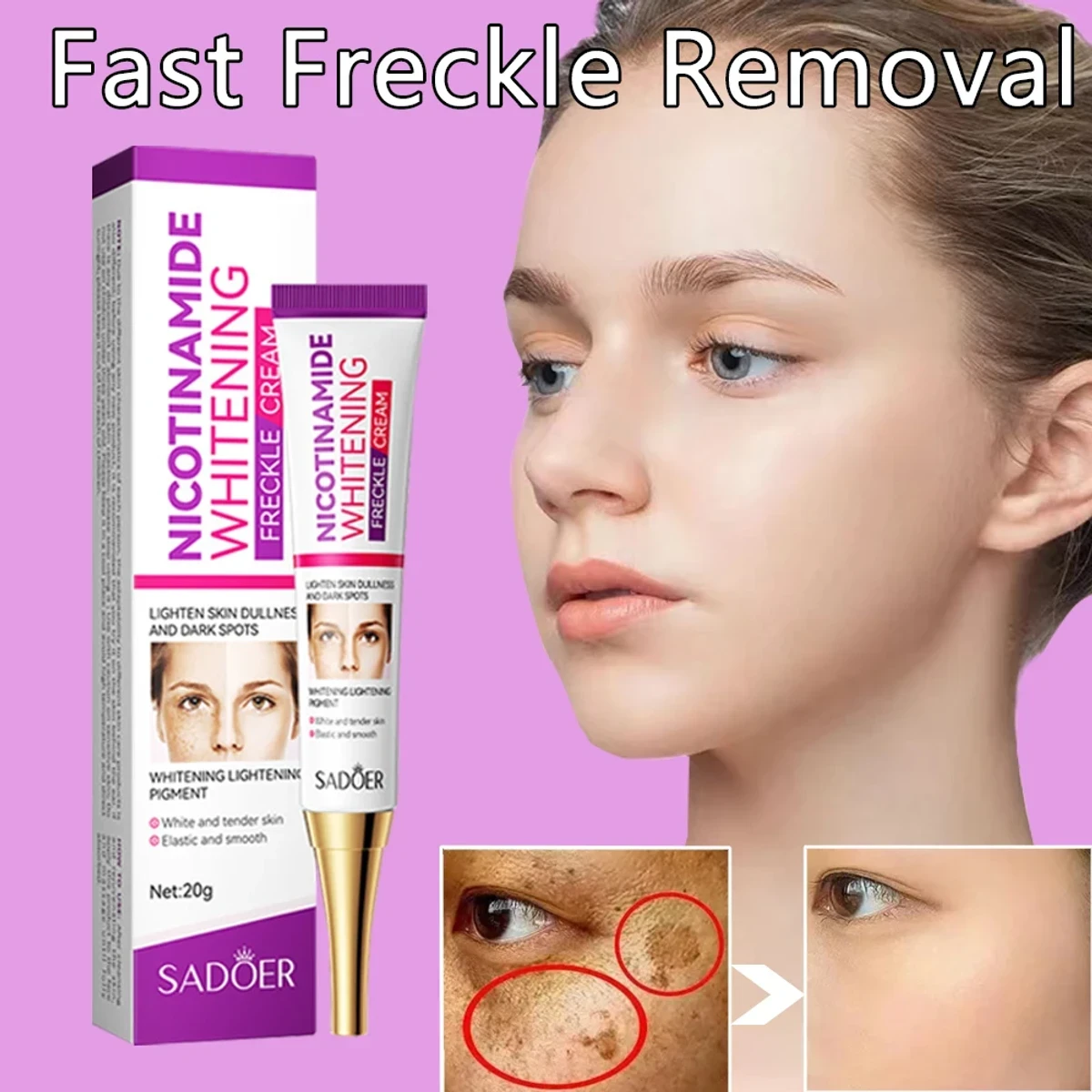 Freckle Removal Cream Moisturizing Moisturizing