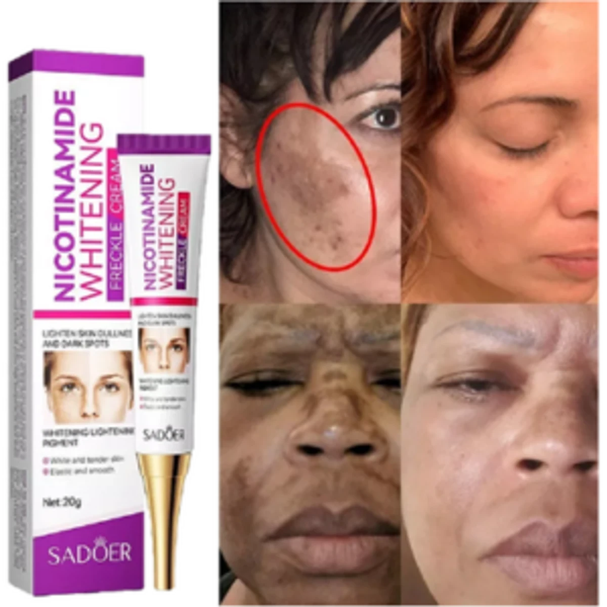 Freckle Removal Cream Moisturizing Moisturizing